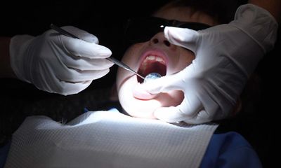 Number of children having rotten teeth extracted in English hospitals rises 17%