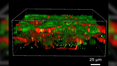 3D-printed human brain tissue works like the real thing