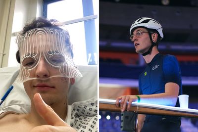 I crashed my bike and broke my face in three places - my helmet might have saved my life