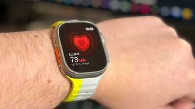 Despite Blood Oxygen ban, Apple Watch is still saving lives — Tim Cook thanks couple for story of South Carolina man saved by heart rate monitoring