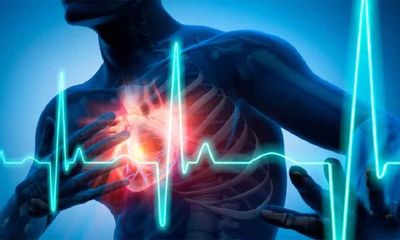 Heart Attack: Gene therapy improves advanced heart failure in animal model