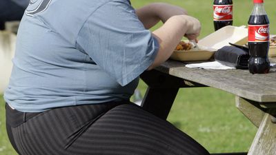 More that 1 billion of world's population is clinically obese, study shows