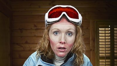 Dress up as a raccoon? Use it to find a mate? Skiers offer hilarious advice for getting rid of your goggle tan