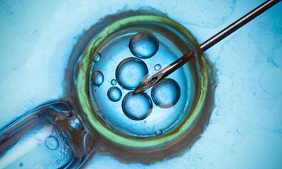 Scientists move step closer to making IVF eggs from skin cells