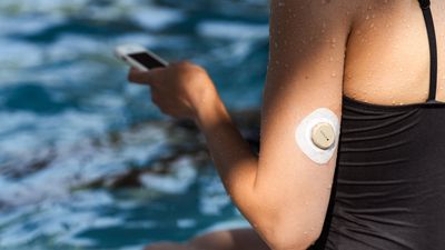 Continuous glucose monitors – health fad or the future of wellbeing?