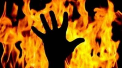 Uttar Pradesh: Man set on fire over land dispute in Chandauli