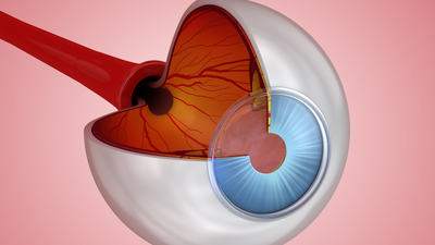 Nature vs. Nurture: Exploring the role of genetics and environmental factors in Glaucoma risk