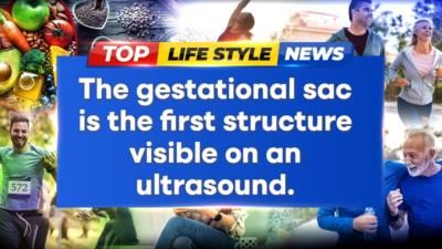 Understanding The Role Of Gestational Sac In Pregnancy Health