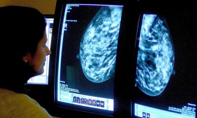 Breast cancer drug may help thousands more women than previously thought