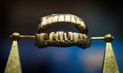 Shock of the old: 10 rotten and repugnant artefacts from dental history