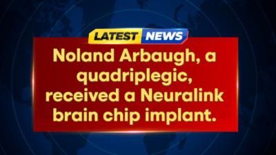 First Neuralink Chip Recipient Shares Life-Changing Experience After Surgery