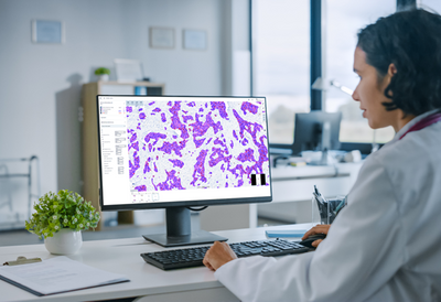 Aiforia Disrupts Cancer Diagnostics With Supervised AI For A More Precise And Efficient Healthcare Future