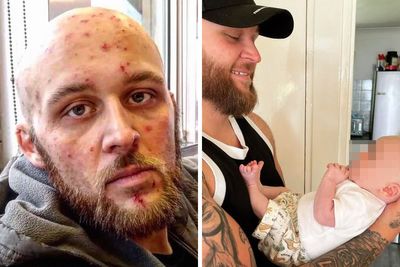 50 Before And After Pictures That Show What Happens When People Overcome Addiction (New Pics)