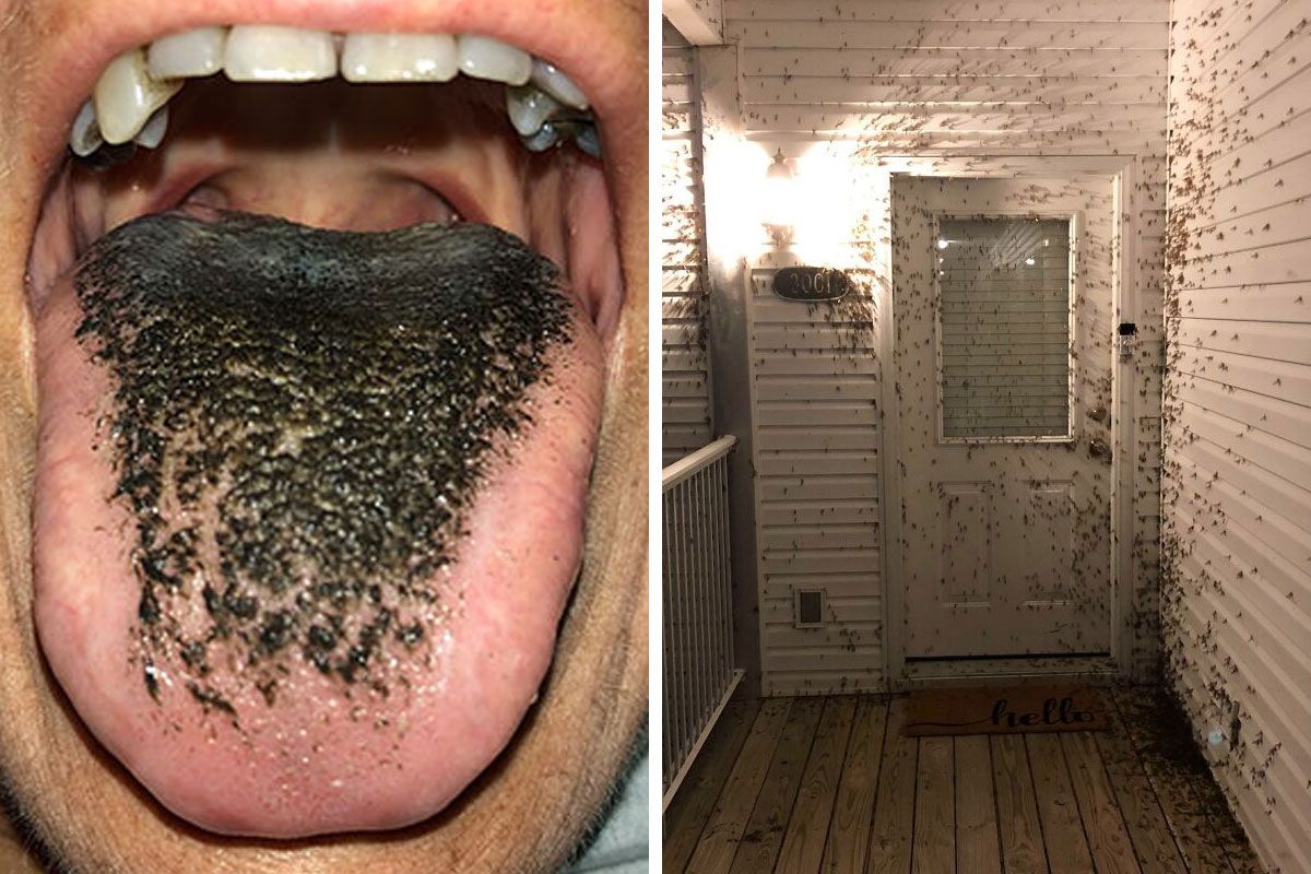 Something Repulsive 55 Times People Came Across Something ‘Mildly…
