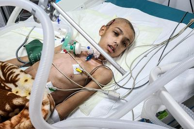 ‘Not a normal war’: doctors say children have been targeted by Israeli snipers in Gaza