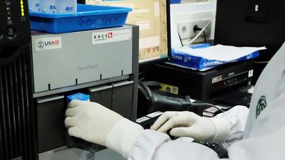 Over-reliance on smear microscopy for TB detection continues