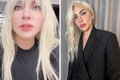 “WHERE ARE YOUR ETHICS?”: Lady Gaga Slammed For Promoting Migraine Med