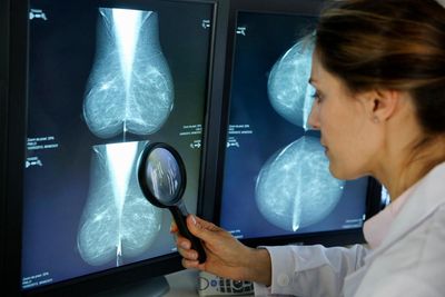 Lower-income US women more likely to miss key breast cancer test, study finds