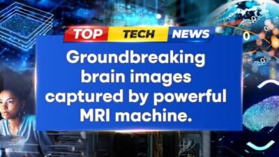 Breakthrough MRI Reveals Detailed Human Brain Images For Research
