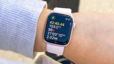 Apple Watch X — 5 upgrades Apple needs to make