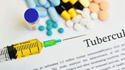 Absence of full drug-susceptibility data for TB patients can result in amplifying resistance: study
