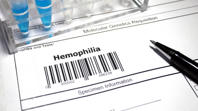 60% Haemophilia cases are undiagnosed due to lack of awareness: Know all about the disease