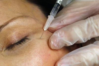 CDC Warns Of Counterfeit Botox Injections Sickening 22 People