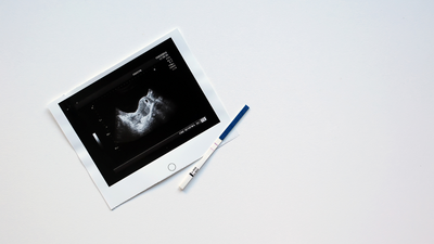 From soap to vinegar: Do homemade pregnancy tests work?