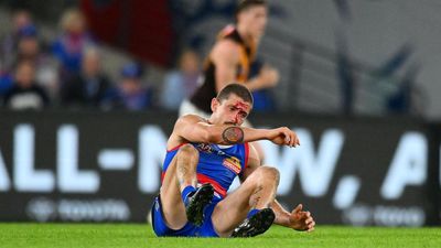 Liberatore on watch after boot to the head
