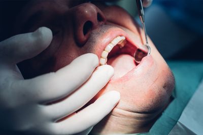 Is wisdom tooth removal unnecessary?