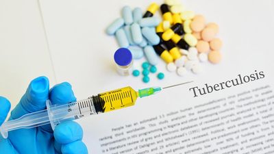 TB vaccine MTBVAC gets CDSCO nod for phase II trials