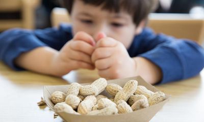 NHS trial uses daily doses of food allergens to tackle severe reactions