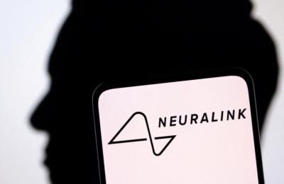 Neuralink's First Test Subject Faces Setback In Brain Chip Implant