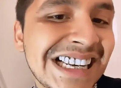 Christian Nodal loses teeth while investing $800,000 in a diamond-encrusted smile