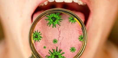 The bacteria in your mouth play an important role in your health – here are four diseases linked to your oral microbiome