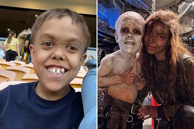 Bullied Boy With Dwarfism Becomes “Furiosa: A Mad Max Saga” Actor, Delights Viewers