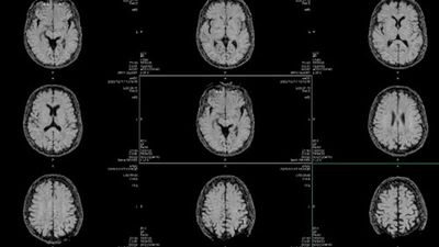 This New Map Of Gene Regulation Could Change The Way We See The Human Brain