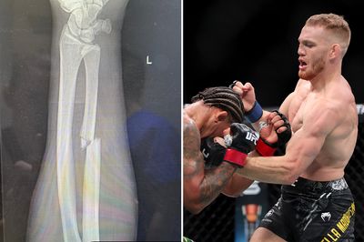 Jack Della Maddalena rules himself out of UFC 305 after complications from arm surgery