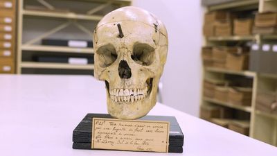 From The Lab: How researchers reconstructed the face of a Napoleonic soldier