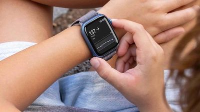 The Apple Watch will now connect to a Dexcom glucose monitor in your arm