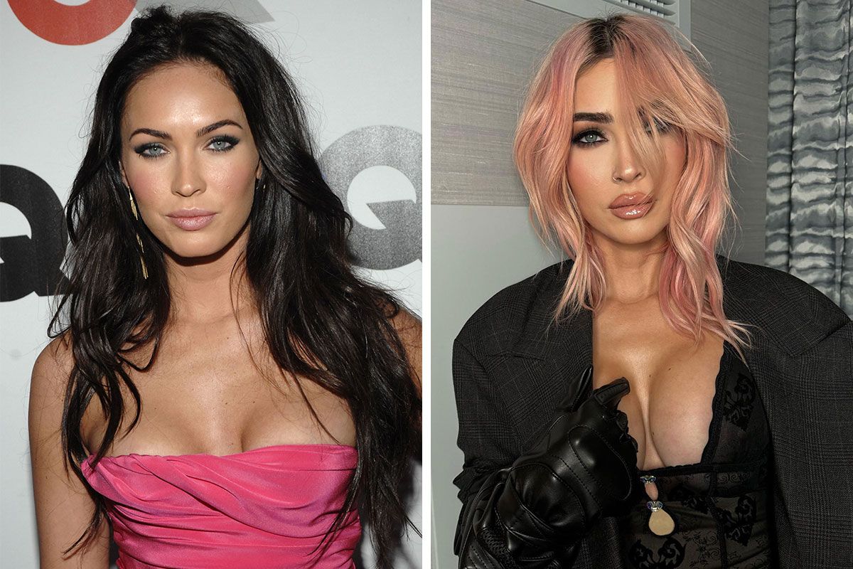 26 Celebrities Before And After Plastic Surgery, Kim…