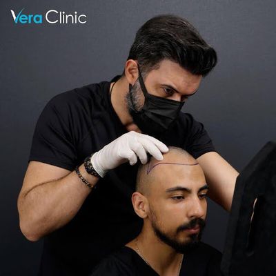 The Role Of Hair Transplantation In Restoring Self-Confidence: A Focus On Turkey