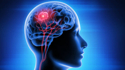 What are the signs and symptoms of brain tumors that the public should be aware of?