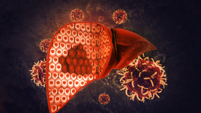 Is sugar to blame for non-alcoholic fatty liver?