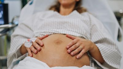 Epidurals may lower risk of complications after birth, study hints