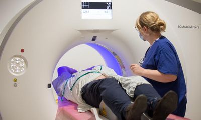 Groundbreaking AI heart attack scans could soon be rolled out across UK