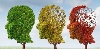 What’s the difference between Alzheimer’s and dementia?