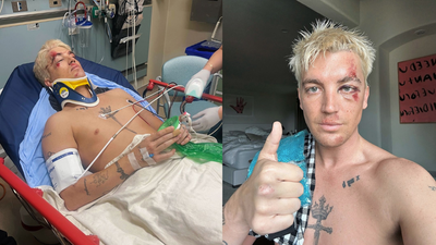 LANY Forced To Postpone Aussie Shows After Guitarist Paul Klein Hit By Car In Horror Accident