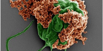 Microrobots made of algae carry chemo directly to lung tumors, improving cancer treatment