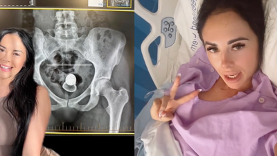 A Gold Coast TikToker Had A Butt Plug Lodged Inside Her For 2 Days Straight After A Sex Mishap